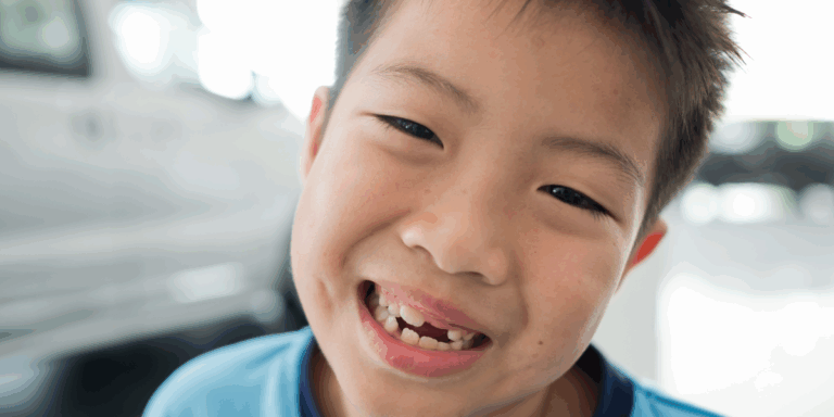 Read more about the article How to Handle a Dental Accident in Singapore